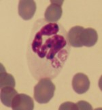 Anaplasma-morula Anaplasma-morula. Mikroskopbild.