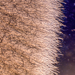 Trådliknande, genomskinliga hyfer. Foto.