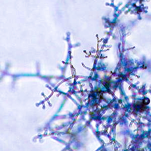 Microscope photo of fungal hyphae. Photo.