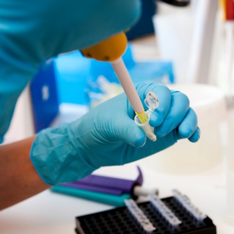 A hand in a blue glove pipettes in a laboratory environment. Photo.