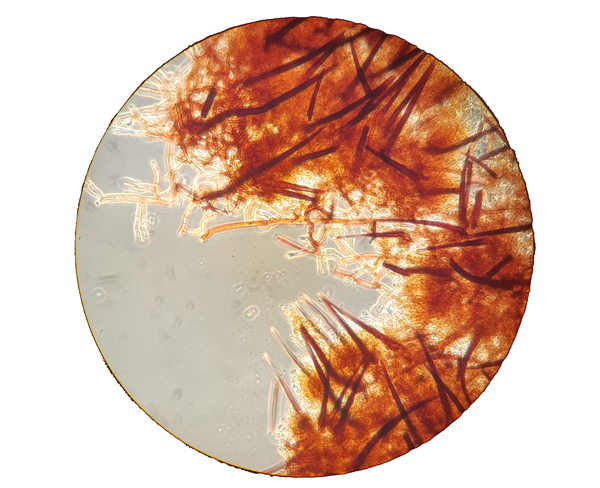 Rust red fungal hyphae in a microscope. Photo.