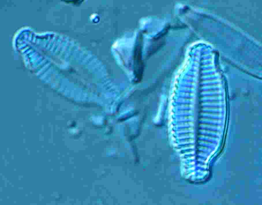 Mikroskopbild på kiselalger. Foto.