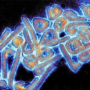 Mikroskop foto av marburgviruset