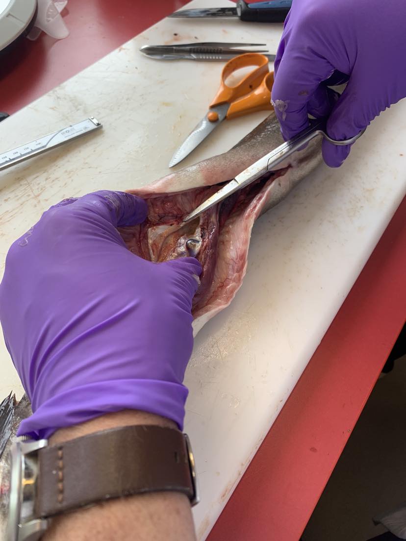 Räkning av simblåseparasit